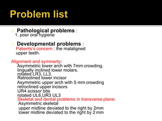 Pathological problems :
1. poor oral hygiene
Developmental problems :
Patients’s concern : the malaligned
upper teeth.
Alignment and symmerty:
Asymmetric lower arch with 7mm crowding.
lingually inclined lower molars.
rotated LR3, LL3.
Retroclined lower incisor
Asymmetric upper arch with 5 mm crowding
retroclined upper incisors
UR4 scissor bite
rotated UL6,UR3 UL3
Skeletal and dental problems in transverse plane:
Asymmetric skeletal
upper midline deviated to the right by 2mm
lower midline deviated to the right by 2 mm
 