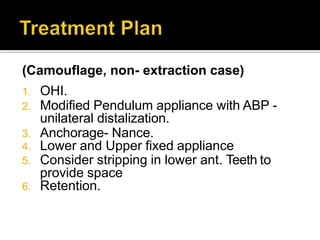 (Camouflage, non- extraction case)
1. OHI.
2. Modified Pendulum appliance with ABP -
unilateral distalization.
3. Anchorage- Nance.
4. Lower and Upper fixed appliance
5. Consider stripping in lower ant. Teeth to
provide space
6. Retention.
 