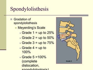 Spondylolisthesis
 Gradation of
  spondylolisthesis
      Meyerding’s Scale
         Grade 1 = up to 25%

         Grade 2 = up to 50%

         Grade 3 = up to 75%

         Grade 4 = up to

          100%
         Grade 5 >100%

          (complete
          dislocation,
 