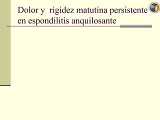 Dolor y rigidez matutina persistente
en espondilitis anquilosante
 