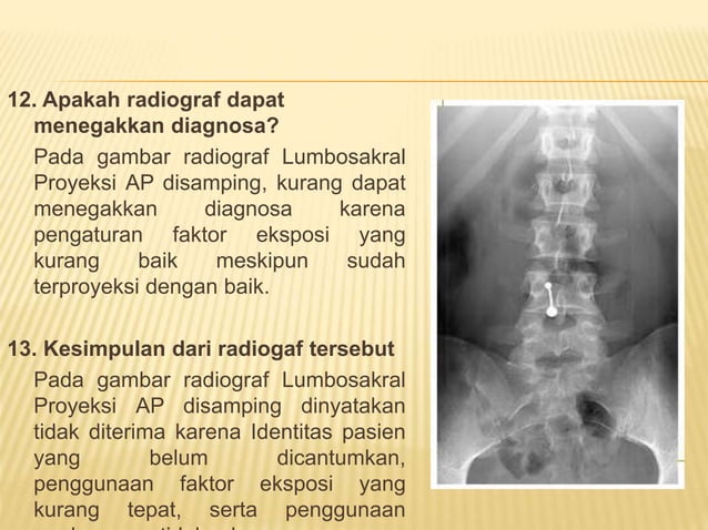 Loopografi Normal Radiologi ppt kritisi dan evaluasi radiograf Lumbal dan Lumbosacral | PPTX
