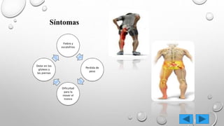 Fiebre y
escalofríos
Perdida de
peso
Dificultad
para la
mover el
tronco
Dolor en los
glúteos y
las piernas
Síntomas
 