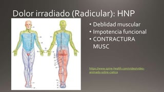 https://www.spine-health.com/video/video-
animado-sobre-ciatica
• Deblidad muscular
• Impotencia funcional
• CONTRACTURA
MUSC
 