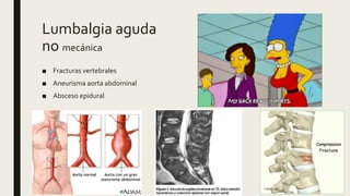 Lumbalgia aguda
no mecánica
■ Fracturas vertebrales
■ Aneurisma aorta abdominal
■ Absceso epidural
 