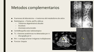 Metodos complementarios
■ Examenes de laboratorios -> trastornos del metabolismo de calcio
■ Radiologicos -> frente, perfil y oblicua
– Trastornos degenerativos discales
– Escoliosis
– Anomaias estructurales
■ Centelleografia oseo radioisotopico
■ Tc -> lesiones anatómicas no detectadas por rx
– Discografia por tc
■ Rm -> ventajas al tener imágenes multiplanares
■ Puncion biopsia
 