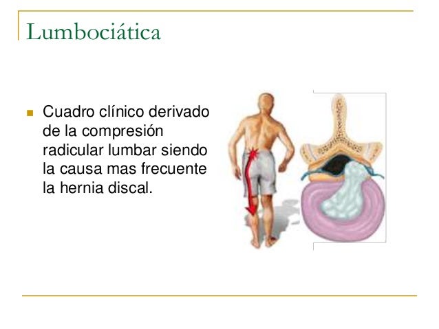 Los ejercicios al dolor en la nuca a sheynom la osteocondrosis