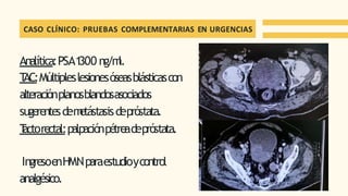 Analítica:PSA1
300 ng/m
l.
T
AC:Múltipleslesionesóseasblásticascon
alteraciónplanosblandosasociados
sugerentesdem
etástasisdepróstata.
T
actorectal:palpaciónpétreadepróstata.
IngresoenHMNparaestudioycontrol
analgésico.
CASO CLÍNICO: PRUEBAS COMPLEMENTARIAS EN URGENCIAS
 