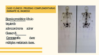 CASO CLÍNICO: PRUEBAS COMPLEMENTARIAS
DURANTE EL INGRESO
Biopsiaprostática:lóbulo
izquierdo
adenocarcinom
a acinar
G
leason8.
G
am
m
agrafia ósea:
m
últiplesm
etástasisóseas.
 