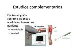 Estudios complementarios
• Electromiografía
confirme lesiones a
nivel de moto neurona
periférica
– No etiología
– No nivel
 