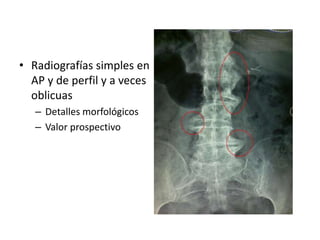 • Radiografías simples en
AP y de perfil y a veces
oblicuas
– Detalles morfológicos
– Valor prospectivo
 