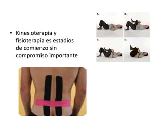 • Kinesioterapia y
fisioterapia es estadios
de comienzo sin
compromiso importante
 