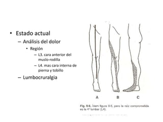 • Estado actual
– Análisis del dolor
• Región
– L3. cara anterior del
muslo-rodilla
– L4. mas cara interna de
pierna y tobillo
– Lumbocruralgia
 
