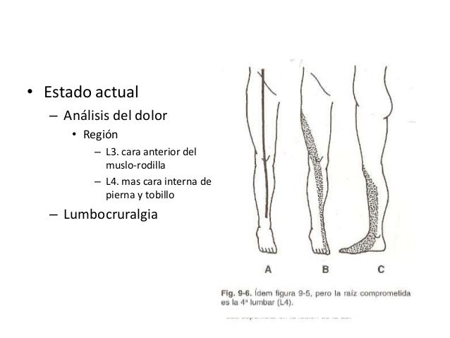 zona lumbar