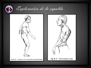 Exploración de la espalda
 