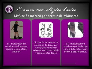 Disfunción marcha por paresia de miómeros
L4: incapacidad de
marcha en talones por
paresia músculo tibial
anterior.
L5: marcha en talones sin
extensión de dedos por
compromiso músculo
extensor del primer ortejo
y común de los dedos
S1: Incapacidad de
marcha en punta de pies
por pérdida de fuerza de
soleos y gastronemios.
Examen neurológico básico
 