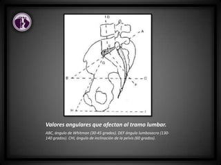 Valores angulares que afectan al tramo lumbar.
ABC, ángulo de Whitman (30-45 grados). DEF ángulo lumbosacro (130-
140 grados). CHI, ángulo de inclinación de la pelvis (60 grados).
 