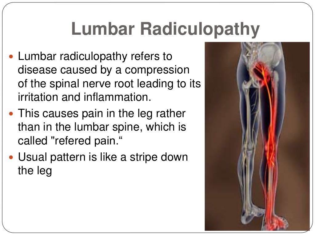 Lumbar spondylosis spondylolisthesis and radiculopath vrogue co