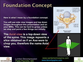 Here is what I mean by a foundation concept. You will see side view images and top down images throughout this presentation and on your MRIs. This can be hard to grasp unless we stop and point a few things out initially The  Axial view  is a top down view of the spine. This image repsents a slice obtained as if an Axe were to chop you, therefore the name Axial view. 