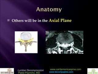 Others will be in the  Axial Plane 