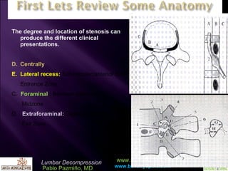 The degree and location of stenosis can produce the different clinical presentations. Centrally Lateral recess:  Subarticular(anterior SAF) Entrance Zone C.  Foraminal  : Between pedicles   Midzone D.  Extraforaminal:  Lateral to pedicle   Exit Zone 