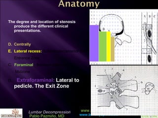 The degree and location of stenosis produce the different clinical presentations. Centrally Lateral recess:  Subarticular(anterior SAF) Entrance Zone C.  Foraminal  : Between pedicles   Midzone D .  Extraforaminal:  Lateral to pedicle. The Exit Zone 