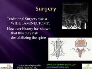 Traditional Surgery was a WIDE LAMINECTOMY.  However history has shown that this may risk destabilizing the spine 