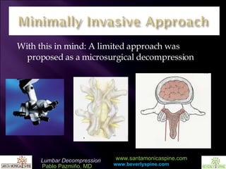 With this in mind: A limited approach was proposed as a microsurgical decompression  
