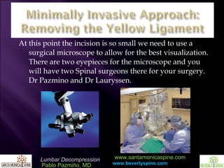 At this point the incision is so small we need to use a surgical microscope to allow for the best visualization. There are two eyepieces for the microscope and you will have two Spinal surgeons there for your surgery. Dr Pazmino and Dr Lauryssen. 