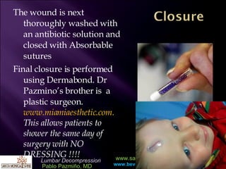 The wound is next thoroughly washed with an antibiotic solution and closed with Absorbable sutures Final closure is performed using Dermabond. Dr Pazmino’s brother is  a plastic surgeon.  www.miamiaesthetic.com.  This allows patients to shower the same day of surgery with NO DRESSING !!!! 