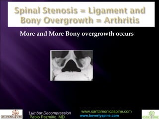 More and More Bony overgrowth occurs 