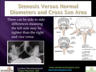 There can be side to side differences meaning the left side may be tighter than the right and vice versa  