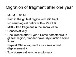 Migration of fragment after one year Mr. M.L. 65 M. Pain in the gluteal region with stiff back No neurological deficit with – Ve SLRT. MRI – free fragment in the sacral canal. Conservatively. Recurrence after 1 year. Some parasthesia in gluteal region, bladder bowel dysfunction some times. Repeat MRI – fragment size same – mild displacement +. Tx – conservatively, asymptomatic 