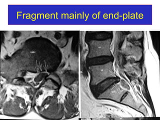 Fragment mainly of end-plate 