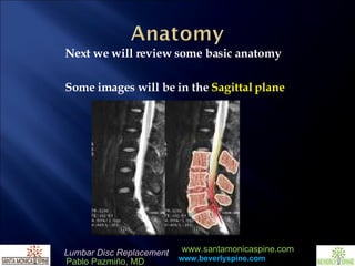 Next we will review some basic anatomy Some images will be in the  Sagittal plane 
