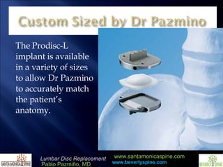 The Prodisc-L implant is available in a variety of sizes to allow Dr Pazmino to accurately match the patient’s anatomy.  