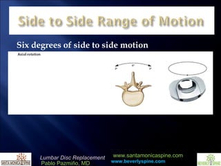 Six degrees of side to side motion 