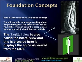 Here is what I mean by a foundation concept. You will see side view images and top down images throughout this presentation and on your MRIs. This can be hard to grasp unless we stop and point a few things out initially The  Sagittal view  is also called the lateral view and this is pictured here it displays the spine as viewed from the SIDE. 