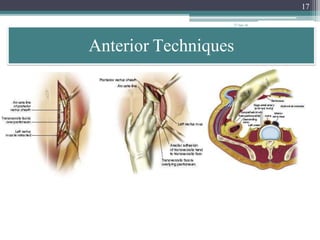 lumbar-interbody-fusionindications-techniques-and-complications ...