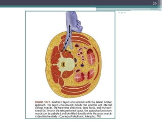 lumbar-interbody-fusionindications-techniques-and-complications ...