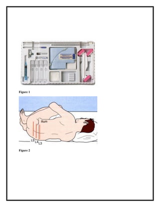 Lp Procedure Guide Lumbar-puncture Procedure. .pdf