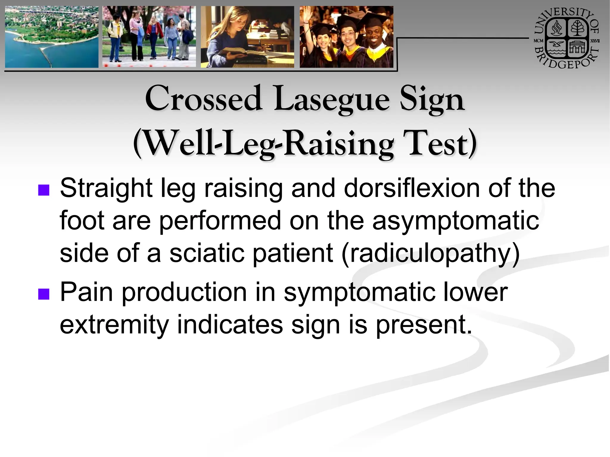 lumbar-radiculopathy estudio clinico.pdf
