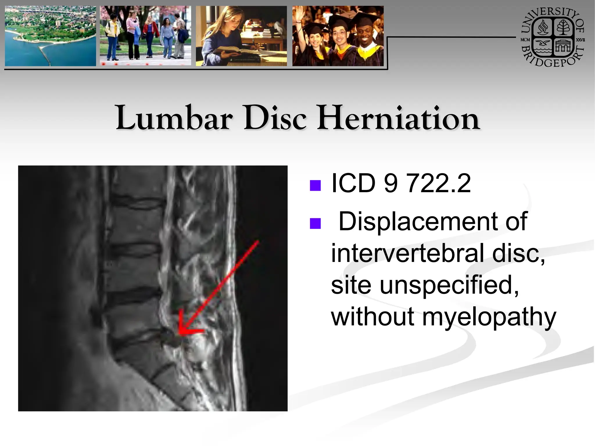 lumbarradiculopathy estudio clinico.pdf