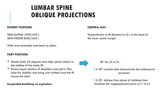 Lpo Rpo Lao Roa LUMBAR-SACRUM-AND-COCCYX Positioning yes | PPTX