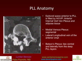 Lubar Arthritis : Lumbar Stenosis by Pablo Pazmino, MD | PPT