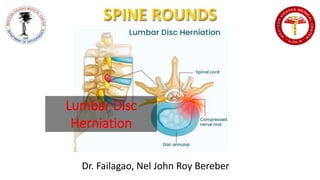 Dr. Failagao, Nel John Roy Bereber
Lumbar Disc
Herniation
 