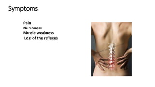 Symptoms
Pain
Numbness
Muscle weakness
Loss of the reflexes
 