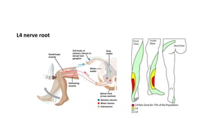 L4 nerve root
 