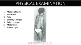 PHYSICAL EXAMINATION
1. Motion of Spine
2. Weakness
3. Pain
4. Sensory Changes
5. Reflex changes
6. Motor skills
7. Special signs
 