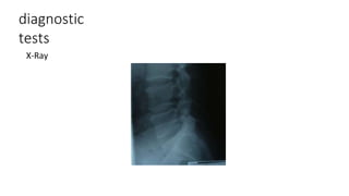 diagnostic
tests
X-Ray
 