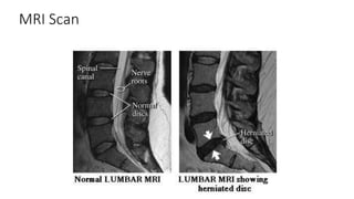 MRI Scan
 